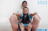 世界上脚最长最大的人，脚长达0.4米(图)