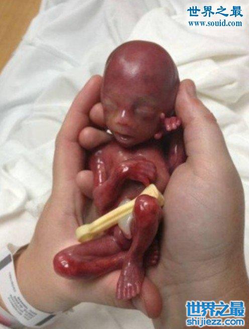 世界上最小的婴儿真人图片