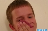美国男孩9厘米的长舌头，能用舌头舔眼睛