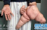 世界上最大的手指