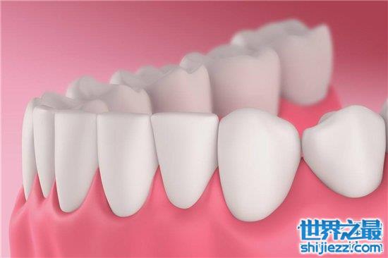 【人有多少颗牙齿 8种牙齿不拔出影响身体疾病 】图3