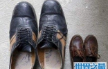 世界上最大的脚，是常人的三倍大