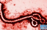世界上最最危险的几个病毒：马尔堡病毒上榜