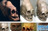 长头骨人的头骨是怎样生长?头顶骨有凸起的人命相