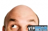 男人头发稀少是怎么回事？吃什么能改善