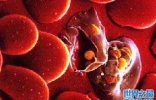 世界十大致命传染病：黑死病上榜，疟疾排第一