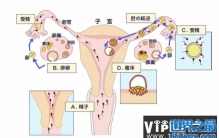 上环这件事，你了解多少？