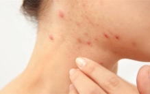 养猫的人为何更容易过敏 原因就在你家主子身上（猫的影响）