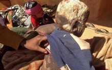 印度男孩患上奇怪病症 皮肤变得坚硬无比（石头人）