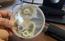 阿根廷出现超级真菌案例 致死率超过一半（超级病毒）