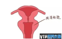 女人阴道松弛怎么办？教你两个方法！