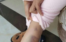 暴力老师殴打孩子 家长看过心疼不已（校园体罚）