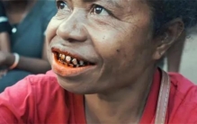 被槟榔摧毁的国家 口腔癌的集中爆发地（槟榔致癌）