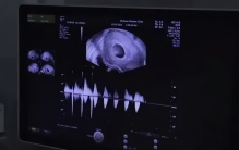 靠《都挺好》走红，40岁的杨祐宁得二胎，曾和郭采洁差点结婚