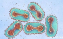 上世纪80年代被消灭 病毒样该被保留吗（天花致死率高）