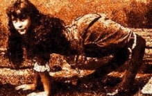 世界上恐怖怪异的畸形人，看完做噩梦（胆小勿入）