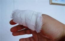 妻子要求买项链被拒绝 丈夫居然砍断自己手指（极端行为）