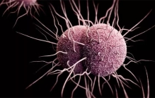 男人没有婚前性行为 做婚检发现有性病（洁身自好）