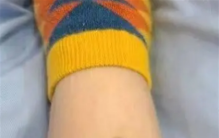 女子住酒店被毒蛇咬伤 酒店拒绝担任全责（酒店安全）