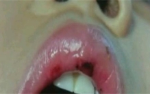 武汉的五岁女孩儿 被老师打八分钟巴掌（虐待儿童）