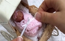 出生不到一斤的婴儿 现在怎么样了（最小婴儿）