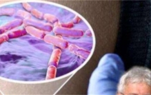 俄罗斯科学家为获永生  注射350万年前猛犸象细菌  结果怎样