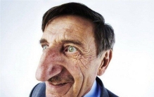 世界上最大的鼻子