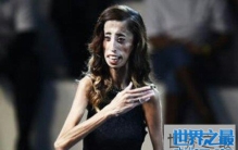 世界最丑的女人是谁 是芙蓉姐姐吗