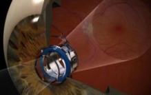 世界上最小的望远镜：仅一毫米大小的微型望远镜