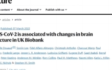 人类大脑的内存，究竟有多大？为什么我们总觉得记忆很模糊？