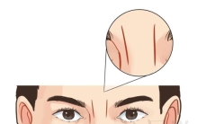 从印堂纹路看你一生运势!,富贵命的印堂纹路