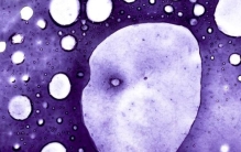 癌细胞能让人类永生吗,细胞无限分裂能永生吗