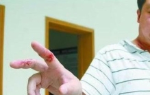 藏獒咬伤主人,藏獒咬了人会很严重吗