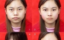 亚洲四大邪术是什么意(整容手术专业术语)