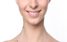 脖子上痣的位置代表什么,脖子上有痣的人代表啥