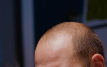 至少打嗝7.1亿次！男子连续打嗝68年，创吉尼斯世界纪录！