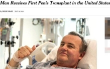 美完成首例阴茎移植手术台媒:64岁男子重振雄风