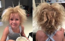 世界上最奇葩的病，它们的确存在（乱乱糟糟）