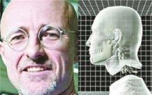 世界首例“换头术”完成 志愿者发出痛苦吱吱声 结局让人心碎