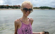 世界上最瘦的人有多瘦?,减肥对身体有哪些危害