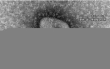 XDXEXL新冠重组毒株到底有多少