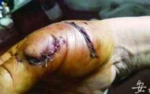 藏獒咬人被打死,藏獒咬伤6人被击毙