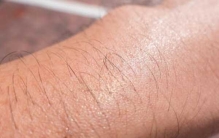 世界上最长的昏睡:因病昏睡42年(母亲守护38年去世)