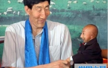 世界上最小的人，可惜很年轻就与世长辞