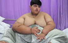 世界上最胖的孩子:10岁就接近400斤(饭量惊人)