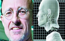 世界上首个换头术 换头术存在的意义真的可以换头成功吗