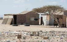 卢旺达一婴儿头部三角形,刚出生的宝宝为什么跟外星人很像