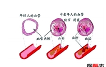世界上最古老的动物，地龙奇迹般的存活了5.7亿年