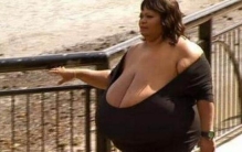 世界上最大胸女的奶，中国丁嘉芬奶重44磅(最大奶重77斤)