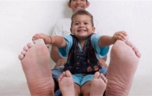 世界上脚掌最大的人 来自委内瑞拉的杰森（最大脚掌）